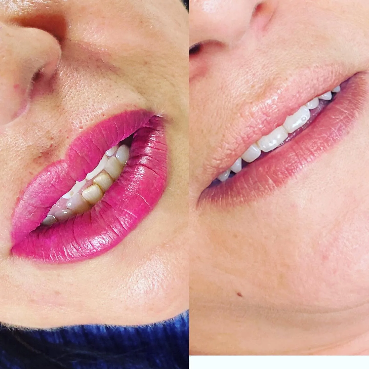 Two lip macros — bright pink then berry lip-blush results