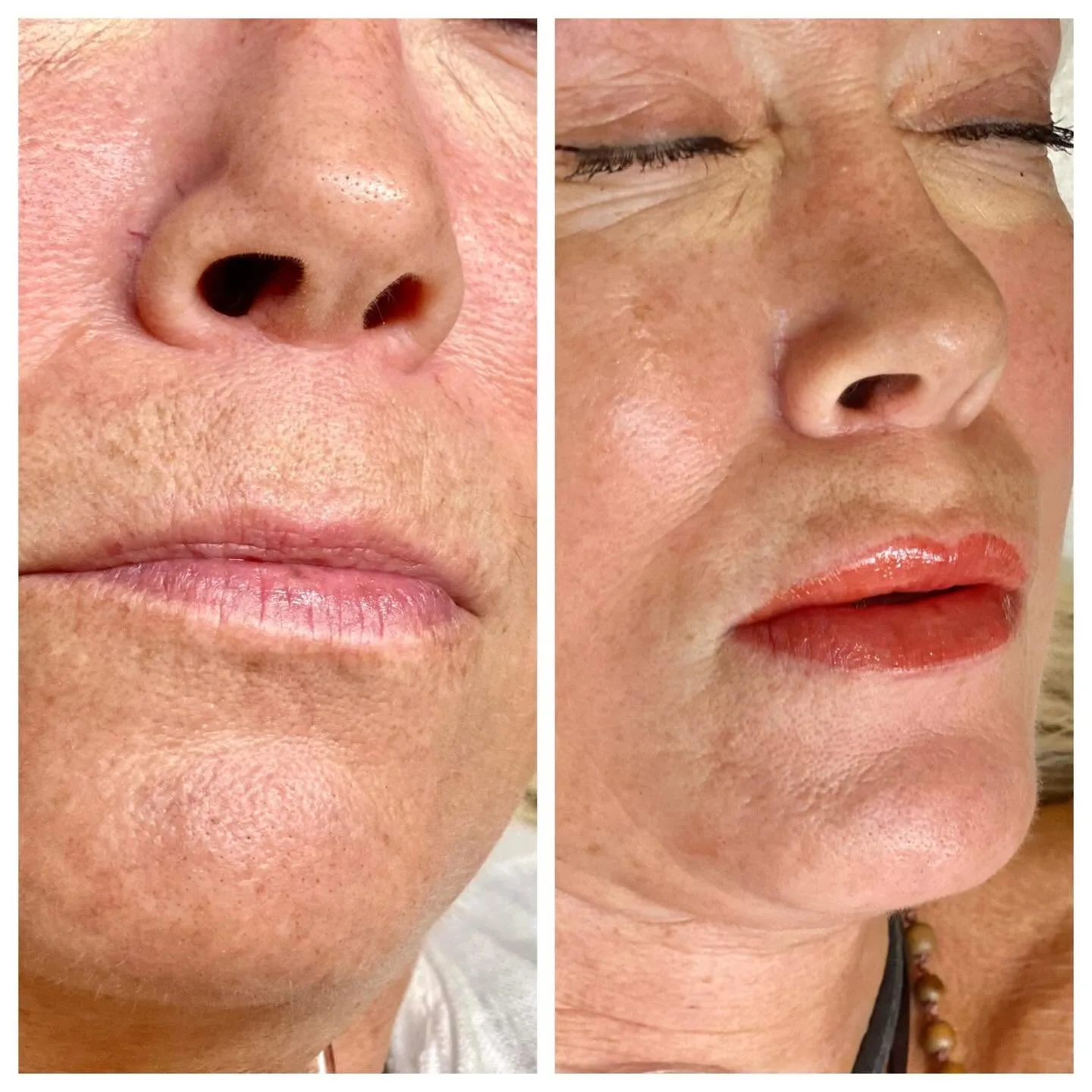 Before and after nose-and-mouth panels — natural then red lip result
