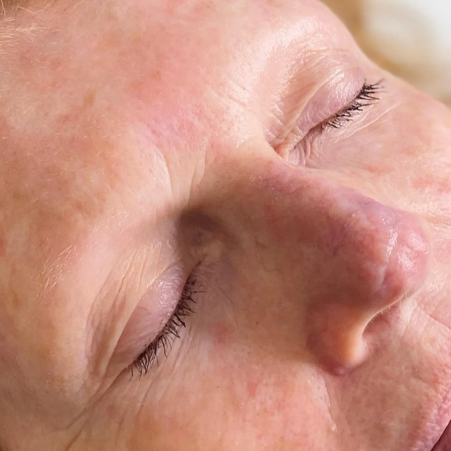 Macro of a closed eye and lashes — healed brow detail